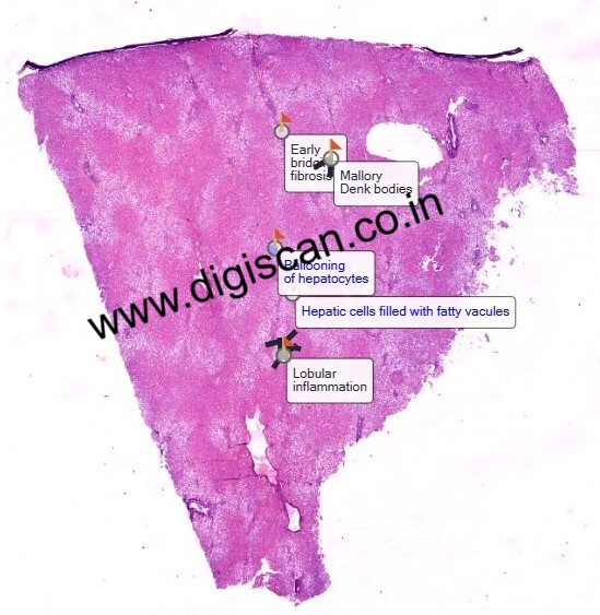 MBBS General Pathology Digital Slides Set (Microscopic Pathology)